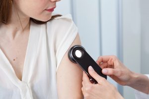 dermatoscopia cancer de pele